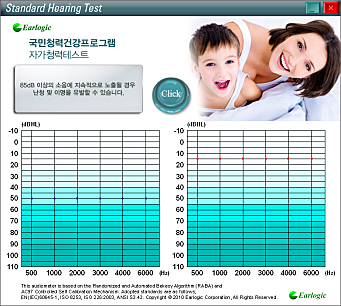 청력검사